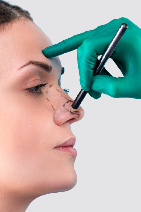 Nasenkorrektur (Rhinoplastik)