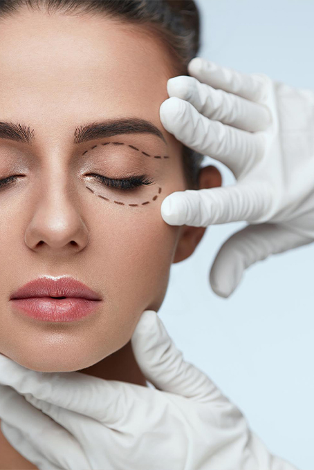 Lidstraffung (Blepharoplastik)